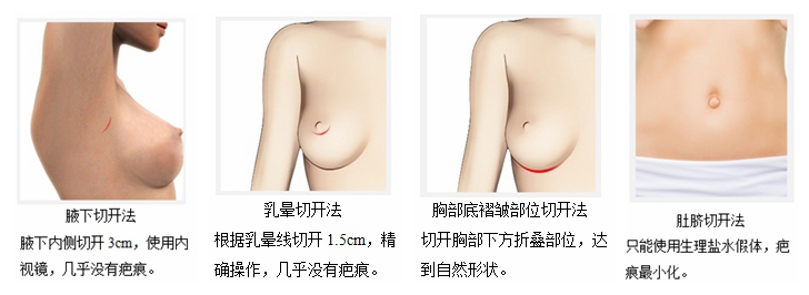 抽脂隆胸价格,抽脂隆胸价格的因素,韩式吸脂隆胸效果怎么样呢？