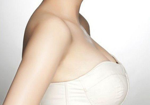 乳房下垂的类型